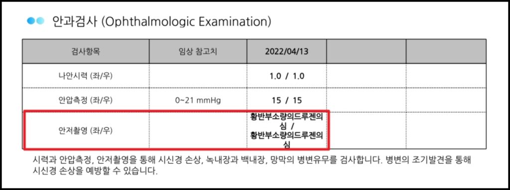 양쪽 눈 모두 안저 검사 결과 드루젠 의심