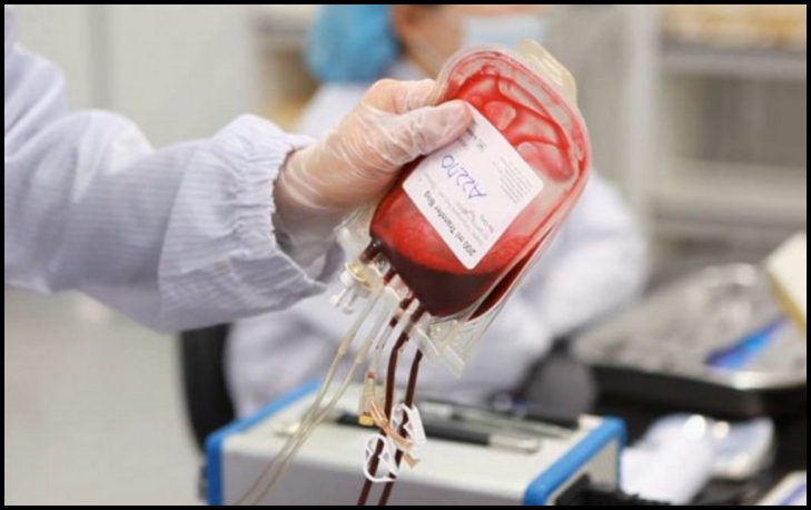 제대혈은 한번 채취한 것으로 단 한번 사용할 수 있기에, 제대혈 보관 방법이 까다롭고, 제대혈 보관 비용도 비쌉니다.