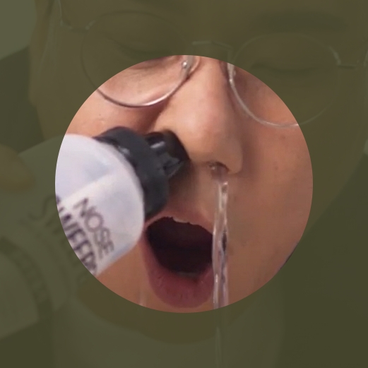 노즈 스위퍼 사용중인 이상민 코세척