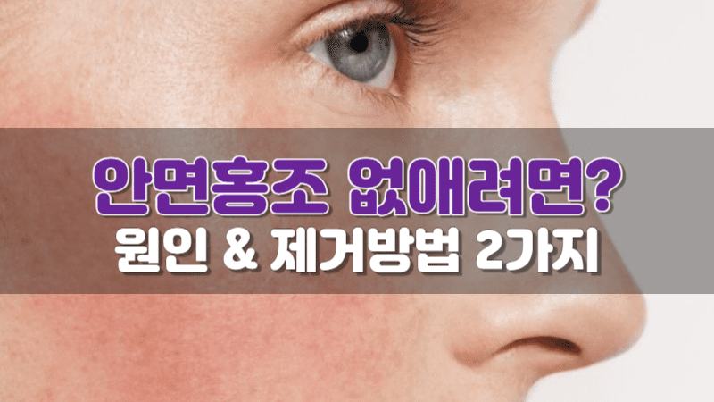 안면홍조 없애는법 2가지(ft.얼굴 홍조 원인) - 정보백과